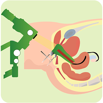 Colposcopy